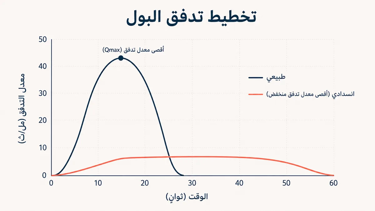 تخطيط تدفق البول يقارن منحنى التدفق الطبيعي بقمةٍ مرتفعة بمنحنى انسدادي منخفض ومطوّل مع انخفاض أقصى معدل تدفق Qmax